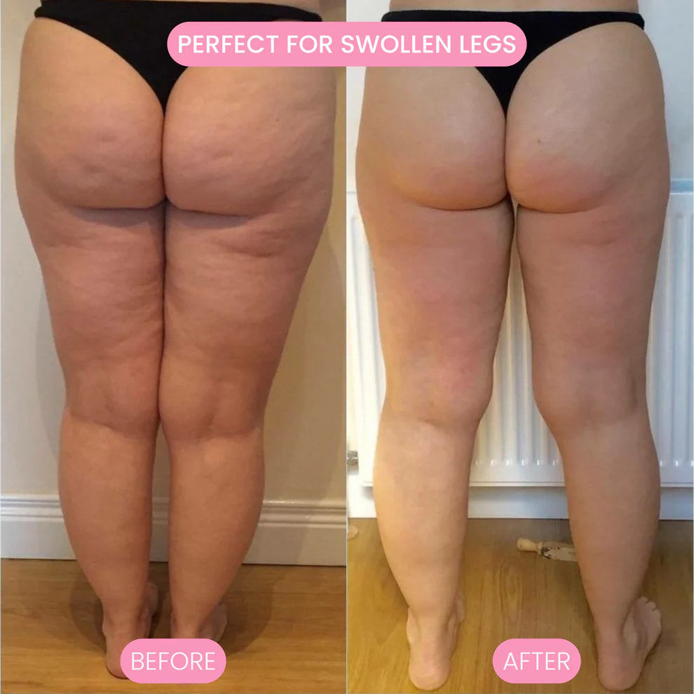Mirella™ CelluLight Pro