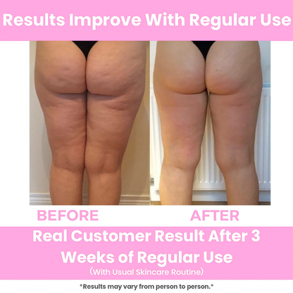 Deep Tissue Massage Roller